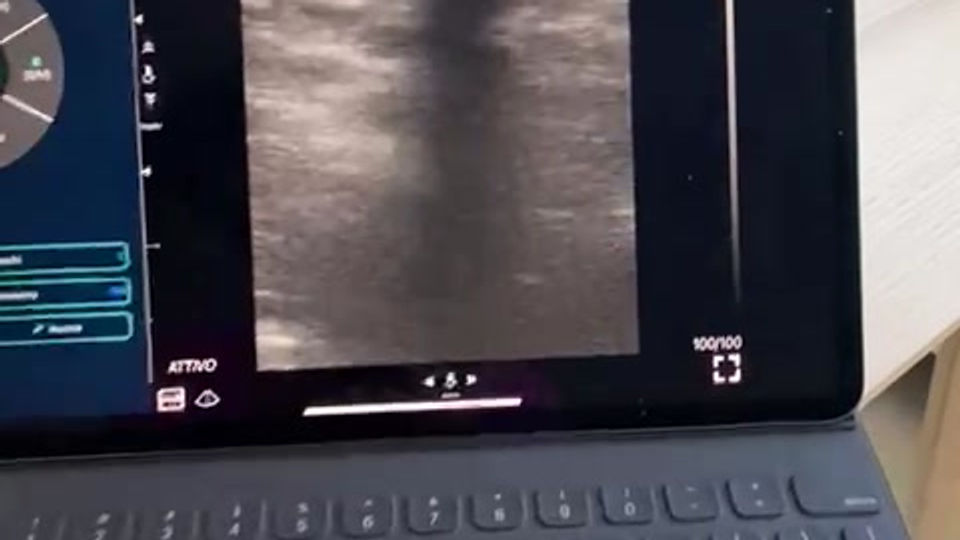 VID-20230311-WA0003